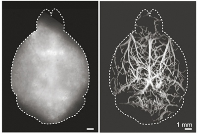 无创荧光显微技术能为大脑深度成像